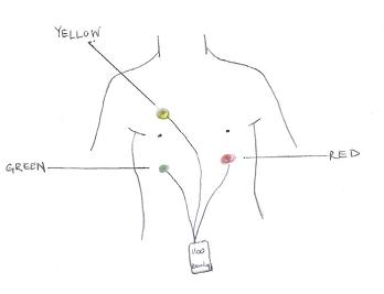 Nursing CPG Holter Monitor Appendix 3